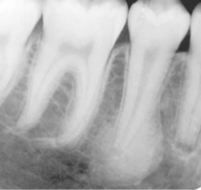 <p>what is the diagnosis </p>