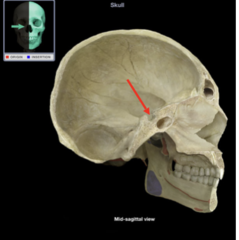 <p>What is the arrow pointing to?</p>