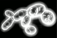 <p>Light objects are visible against a dark background</p><p>Opaque disk placed in condenser</p><p>Only light reflected off the specimen enters the objective lens</p><p>Used to visualize Treponema palldum</p>