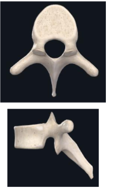 <ul><li><p>long spinous process hich projects donards</p></li></ul><p></p>