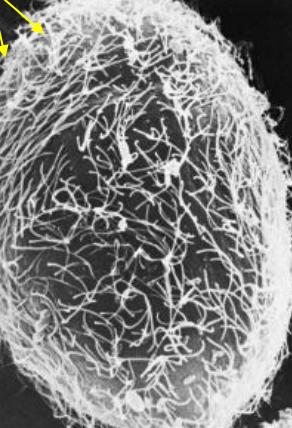 <p>What type of protozoan is this likely?</p>