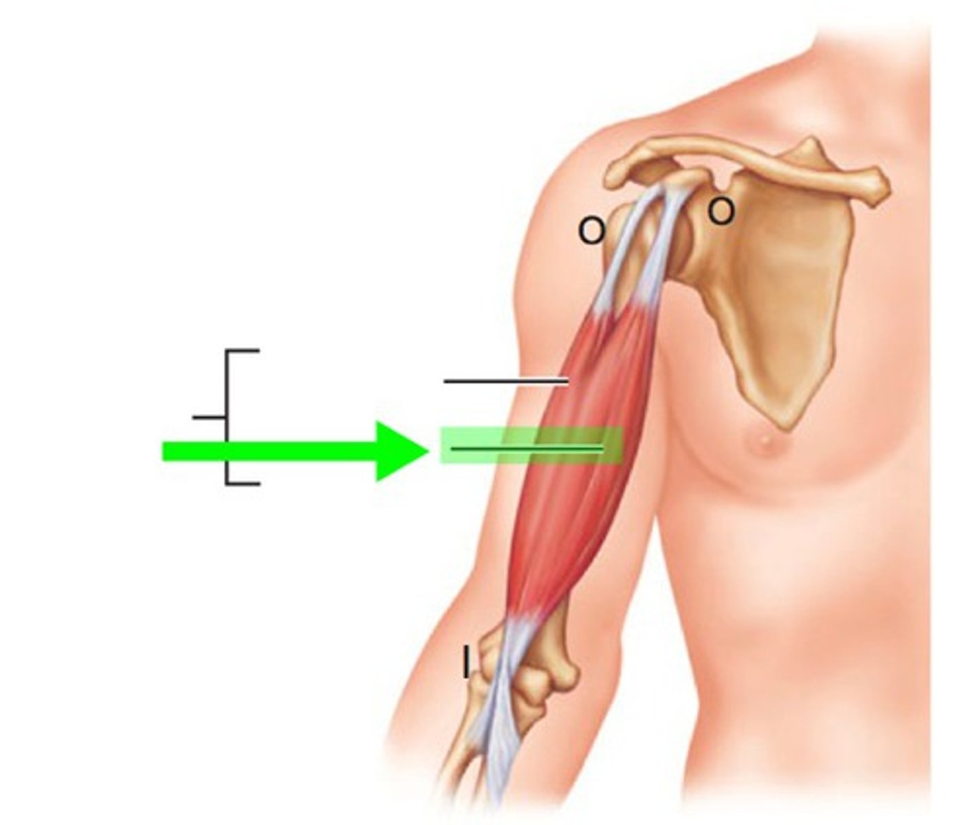 <p>medial biceps</p>