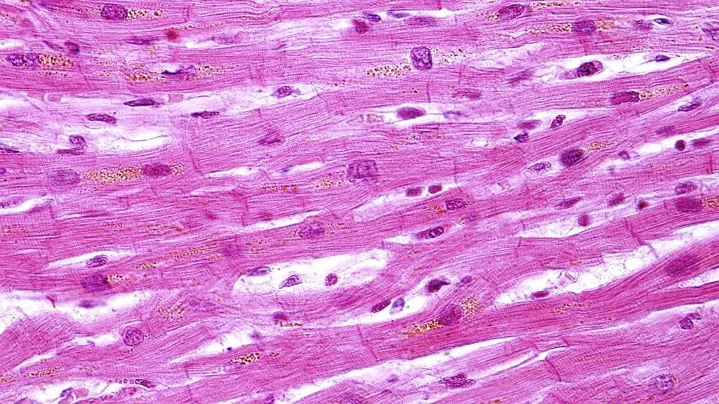 <p>striated, branching fibers that end in intercalating discs, central nucleus</p>