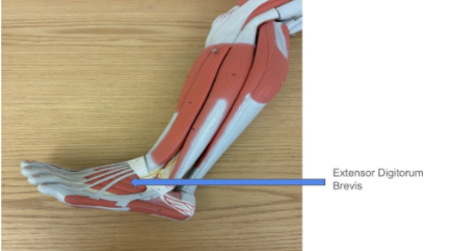 <p><span style="background-color: transparent; font-family: "Times New Roman", serif;">Extensor Digitorum Brevis</span></p>