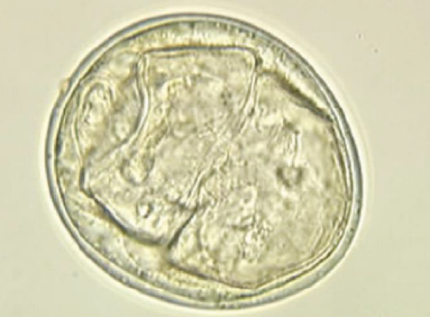 <p><span style="color: blue;">Schistosomiasis</span>: Diagnosis and Treatment</p>