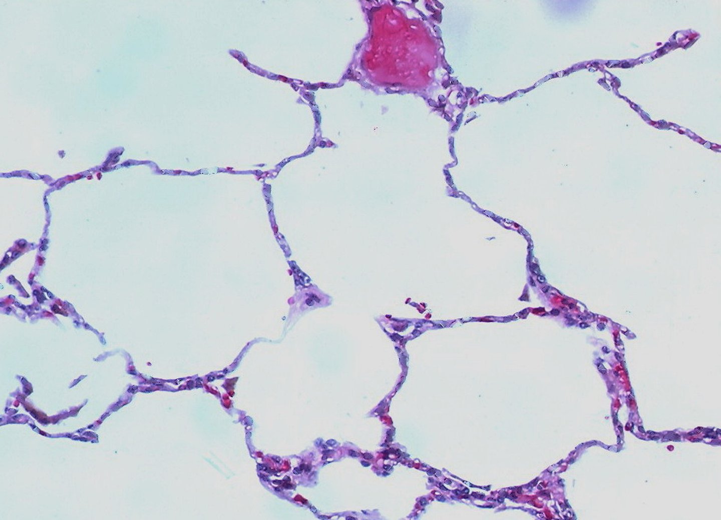 <p>large, simple squamous epithelial cells, air sacs</p>
