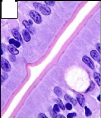 <p>ONE layer (simple) of column shaped cells (columnar) </p><p>Goblet Cells</p>