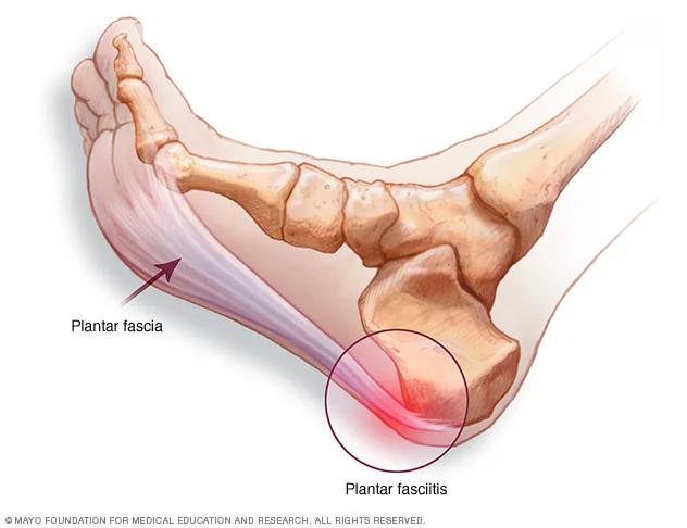 <p>the sole of the foot</p>