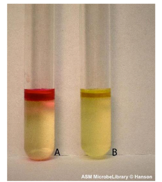 <p>Which tube indicates positive results for indole production? </p>