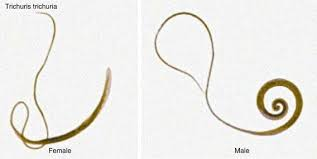<p>whipworm-southern U.S.
transmission: ingest infective eggs from soil or on food
Adult worms live in colon</p>