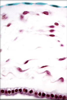 <p>What Eputhelium is this and where is it located?</p>