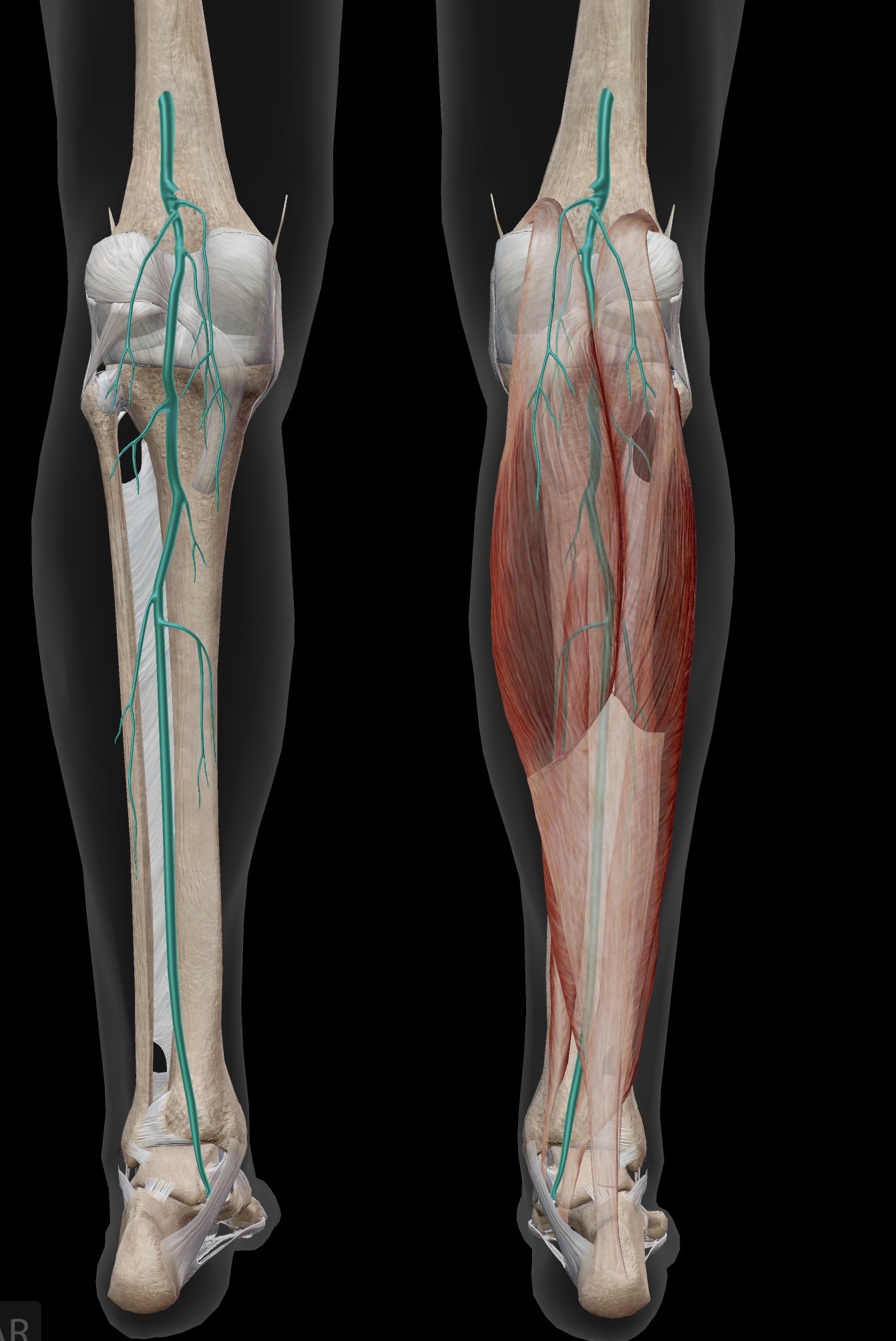 <p>Tibial nerve</p>