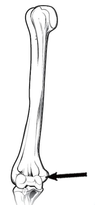 <p>What is this pointing to? What bone is it on?</p>