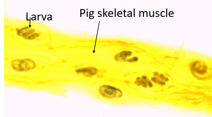 <p>Helminths</p>
