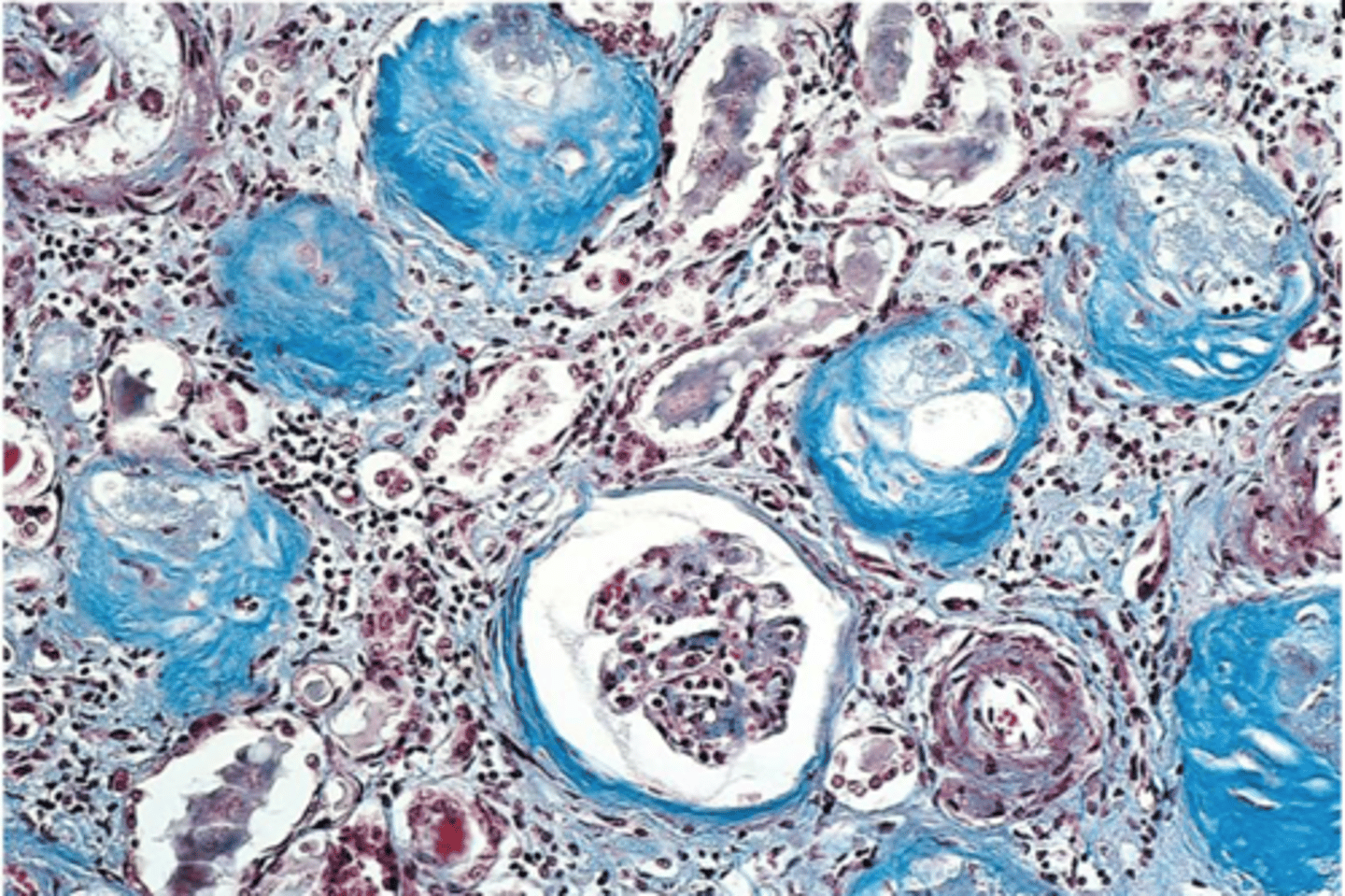 <p>collagen</p>