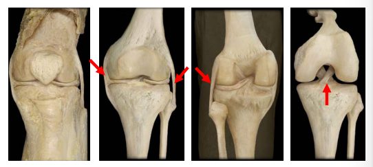 <p>Ligaments derived from the articular capsule that give joints strength and stability. They can be intracapsular or extracapsular.</p>