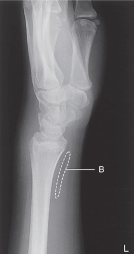 <p>B</p>