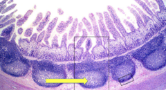 <p>-in ileum</p>
