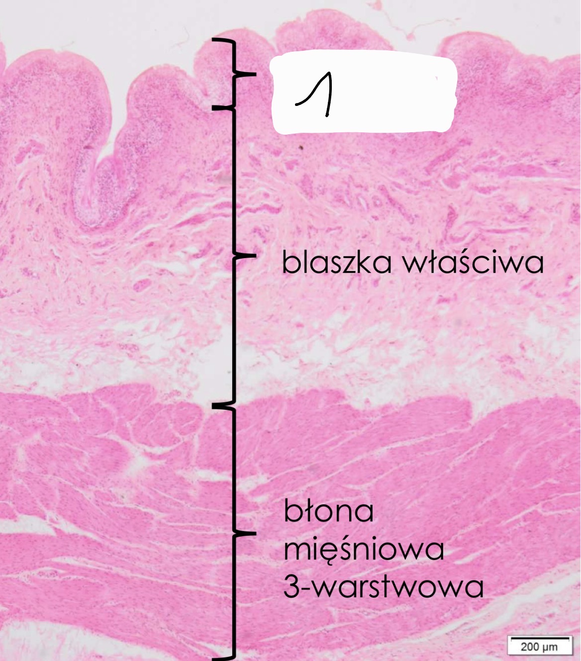 term image