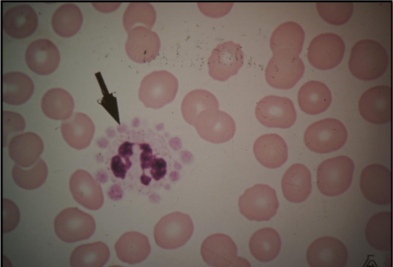 <p>What is this cell anomaly?</p>