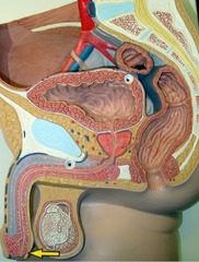 <p>Identify this structure.</p>