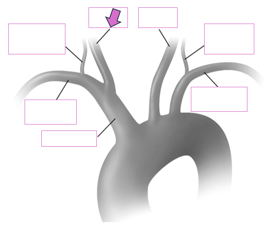 <p>Based on the indicated area, identify this vessel</p>