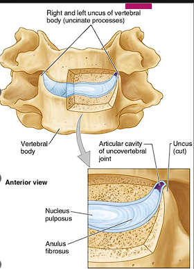 <ul><li><p><span style="font-family: "Century Gothic";">Between uncinate process of the lower vertebrae and the body of the vertebrae above</span></p></li></ul><ul><li><p><strong>Found </strong><span style="color: red;"><strong>ONLY in the cervical spine </strong></span><strong>(typically </strong><span style="font-family: "Century Gothic"; color: red;"><strong>C3-7</strong></span><span style="font-family: "Century Gothic";"><strong>)</strong></span></p></li></ul><ul><li><p><span style="font-family: "Century Gothic";">Lateral and posterolateral margins of IV discs</span></p></li></ul><ul><li><p><span style="color: red;"><strong>Considered synovial joint</strong></span></p></li></ul><ul><li><p><span style="font-family: "Century Gothic"; color: red;">Clefts (degenerative spaces)</span></p><ul><li><p><span style="font-family: "Century Gothic";">Degenerative spaces in the discs occupied by extracellular fluid</span></p></li></ul></li><li><p><strong>Clinical correlation:</strong></p><ul><li><p><span style="font-family: "Century Gothic";">Sites of bone spur (osteophyte) formation neck pain</span></p></li></ul></li></ul><p></p>