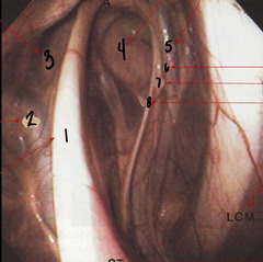 <p>What is 3?</p>