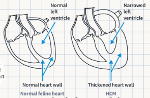 <p>A heart condition where the <strong>left ventricle's muscles thicken</strong>, reducing blood capacity and pumping ability. The cause is <strong>not fully understood, but there may be a genetic link</strong>.</p>