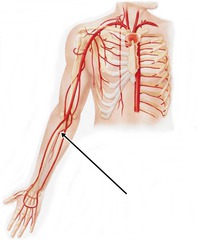 <p>Ulnar artery</p>