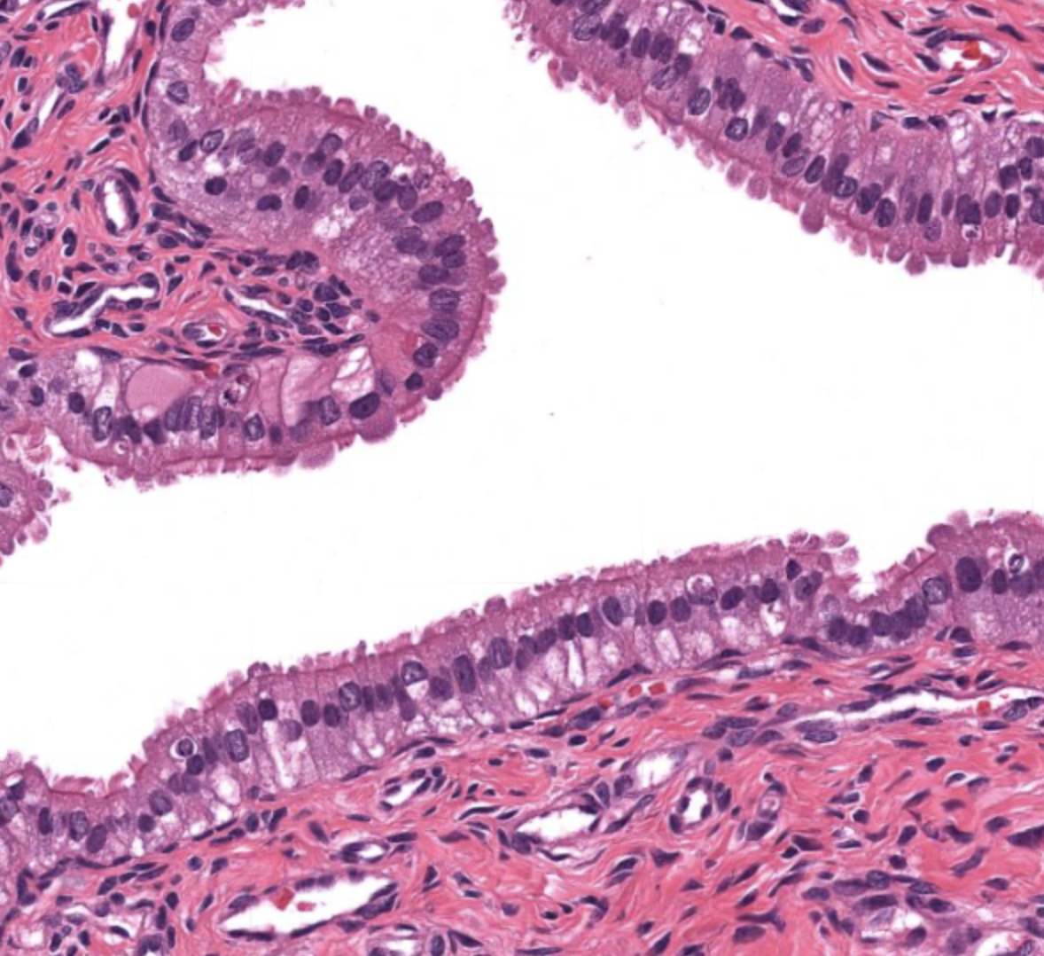 <p>tissue type</p>