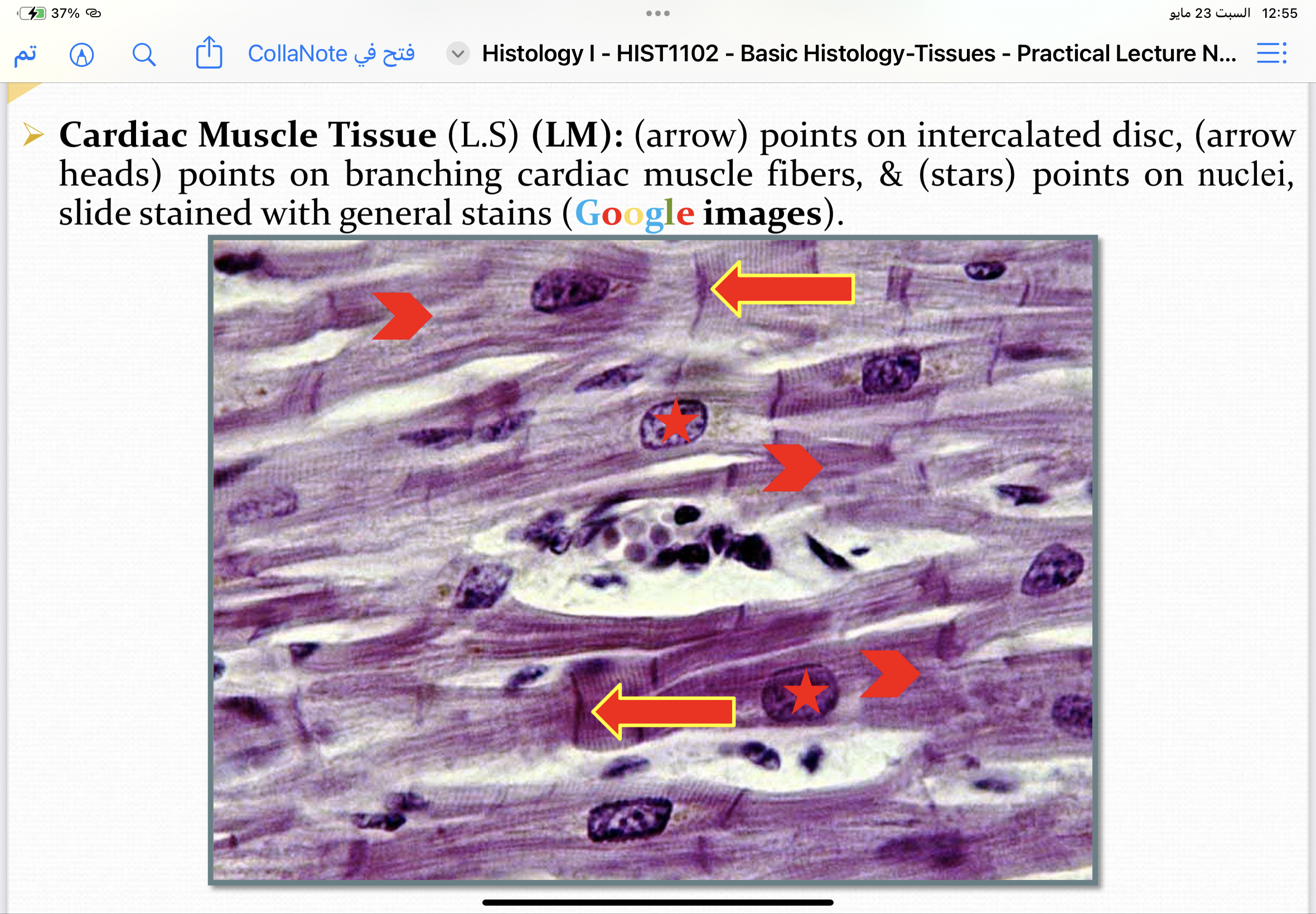 <p>Mast cell</p>