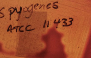 <p>35. Give an example of a beta hemolytic bacterium.</p>