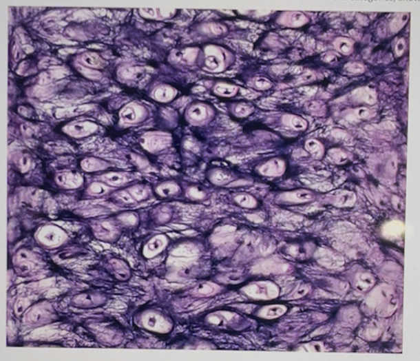 <p>Identify the SPECIFIC type of tissue (NOT epithelial/connective/muscle/nervous categories) shown in the entire image below.</p>