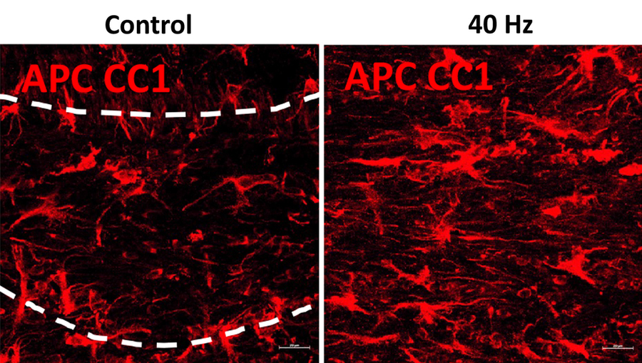 <p>mature oligodendrocytes</p>