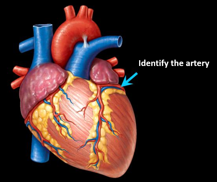 <p>Identify the artery? </p>