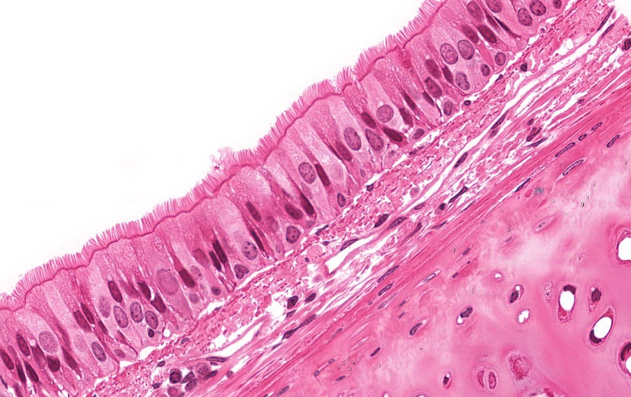 <p>Tejido que se encuentra en mucosas respiratorias <u><mark data-color="#00af58" style="background-color: rgb(0, 175, 88); color: inherit;">desempeñando funciones importantes de secreción</mark></u>:</p>