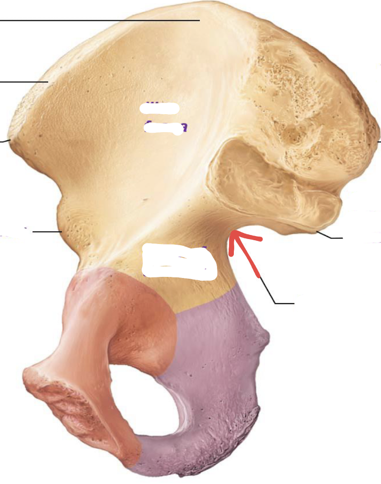 <p>what is this part of the hip?</p>