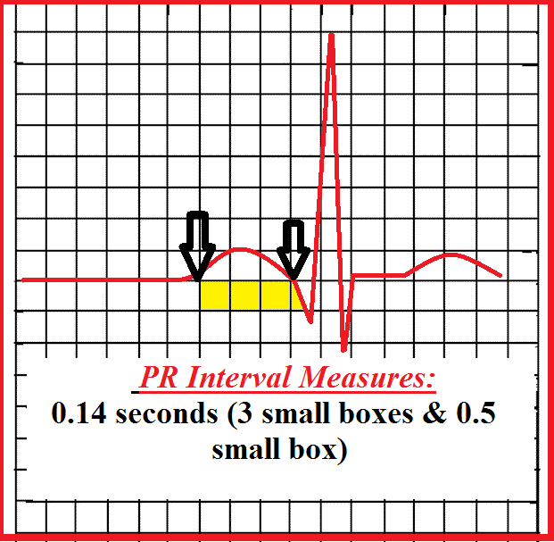 <p>second interval </p><p>AV node conduction delay</p>