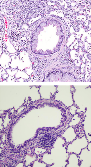 <p>Compare these two images, which is abnormal </p>