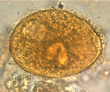 <ul><li><p>only pathogenic intestinal ciliate</p></li><li><p>lives in the large intestine and does not migrate</p></li><li><p>cyst (infective form)</p></li><li><p>trophozoite</p><ul><li><p>oval shaped, slightly pointed end</p></li></ul></li></ul><p></p>