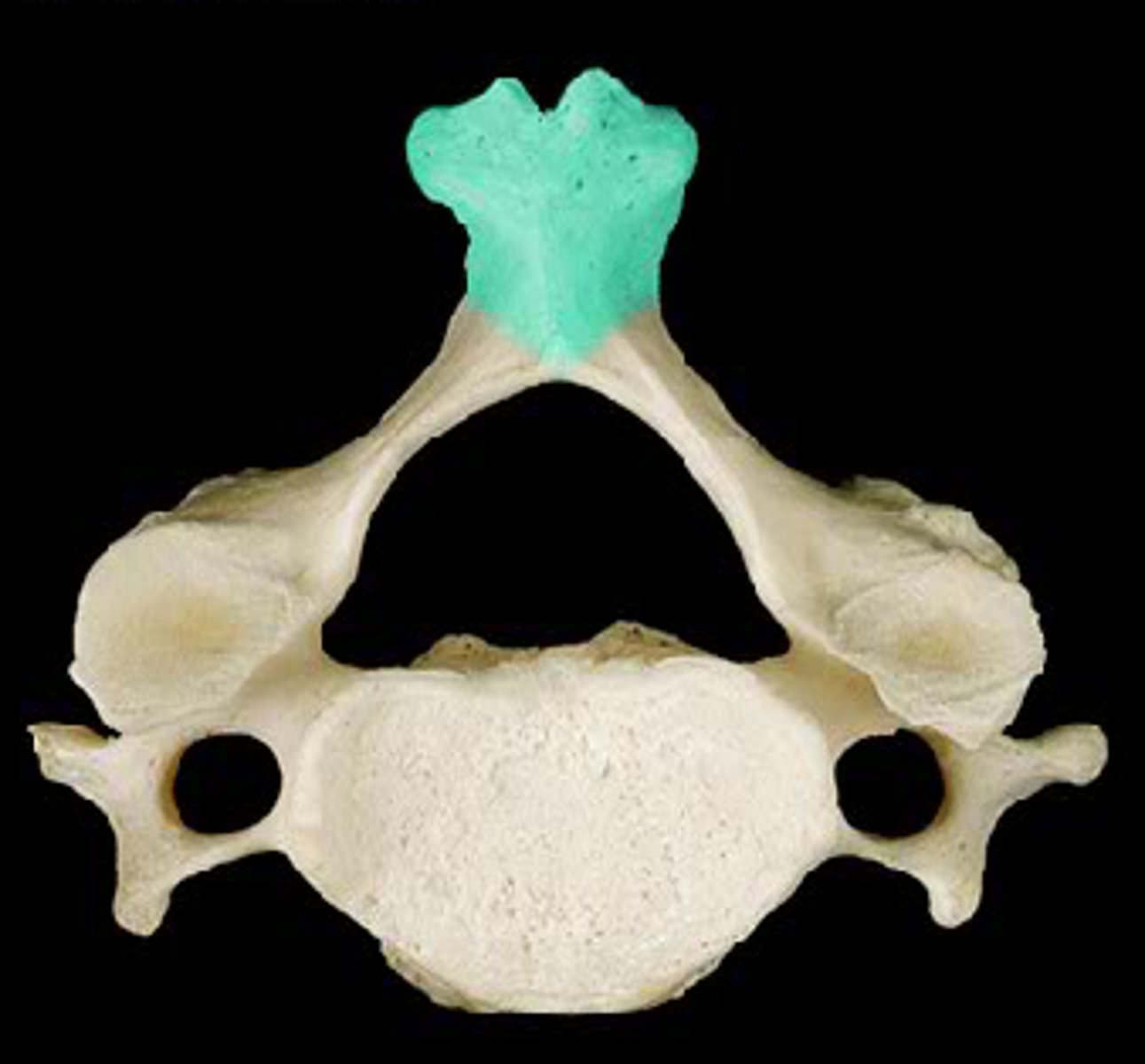 <p>Posterior projection, tip top pointer</p>