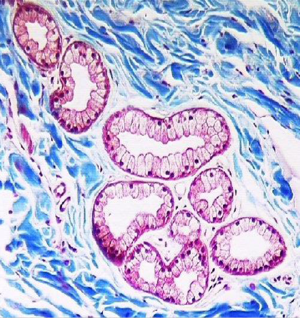 <p>What type of gland?</p>