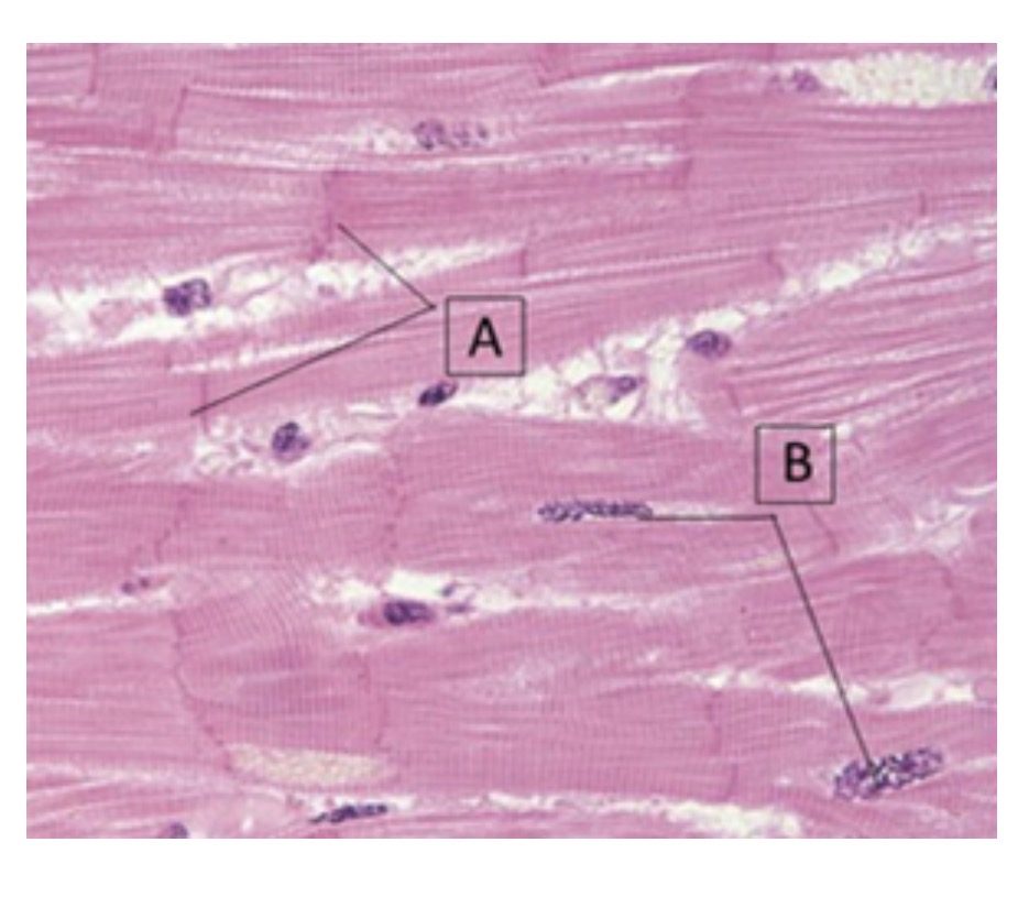 <p>identify this muscle tissue</p>