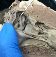 <p>identify the structure</p>