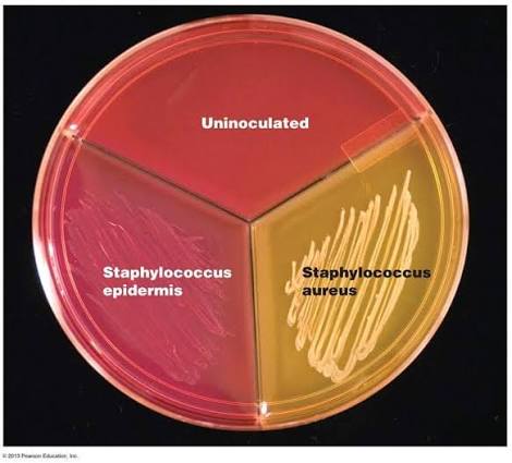 <ul><li><p><span><strong>High Salt (7.5% NaCl):</strong> Acts as the <strong>selective agent</strong>. It prevents the growth of most Gram-negative and non-salt-tolerant Gram-positive bacteria, allowing only halotolerant species (like <em>Staphylococcus</em>) to thrive.</span> [1, 2, 3, 4]</p></li><li><p><span><strong>Mannitol:</strong> Acts as the <strong>differential agent</strong>. It is a fermentable sugar alcohol.</span> [1, 2]</p></li><li><p><span><strong>Phenol Red:</strong> Functions as a <strong>pH indicator</strong>. It is red at neutral pH, turns pink in alkaline conditions, and changes to bright yellow at acidic pH levels (below 6.8).</span> [1, 2]</p></li></ul><p></p>