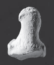 <p>distal foot phalanges (superior)</p>