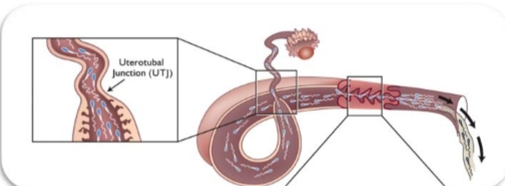<ul><li><p>Limits number of sperm reaching oviduct</p></li><li><p>Acts as a 2nd filter</p></li><li><p>Sperm reservoir</p></li><li><p>Affected by estrogen: Progesterone</p></li></ul><p></p><p><span>Analogy: <strong>I</strong></span><span style="font-family: "Cambria Math";"><strong>‑</strong></span><span><strong>40 going from 4 lanes → 2 lanes.</strong></span></p><p>Functions:</p><ul><li><p><span>Limits sperm entry into the oviduct</span></p></li><li><p><span>Ensures only <strong>high</strong></span><span style="font-family: "Cambria Math";"><strong>‑</strong></span><span><strong>quality, capacitated sperm</strong> pass</span></p></li><li><p><span>Prevents polyspermy by controlling sperm numbers</span></p></li></ul><p><span><strong>Special case:</strong></span></p><p>Some species (e.g., bats) use the UTJ as a <span><strong>sperm reservoir</strong></span> for months.</p>