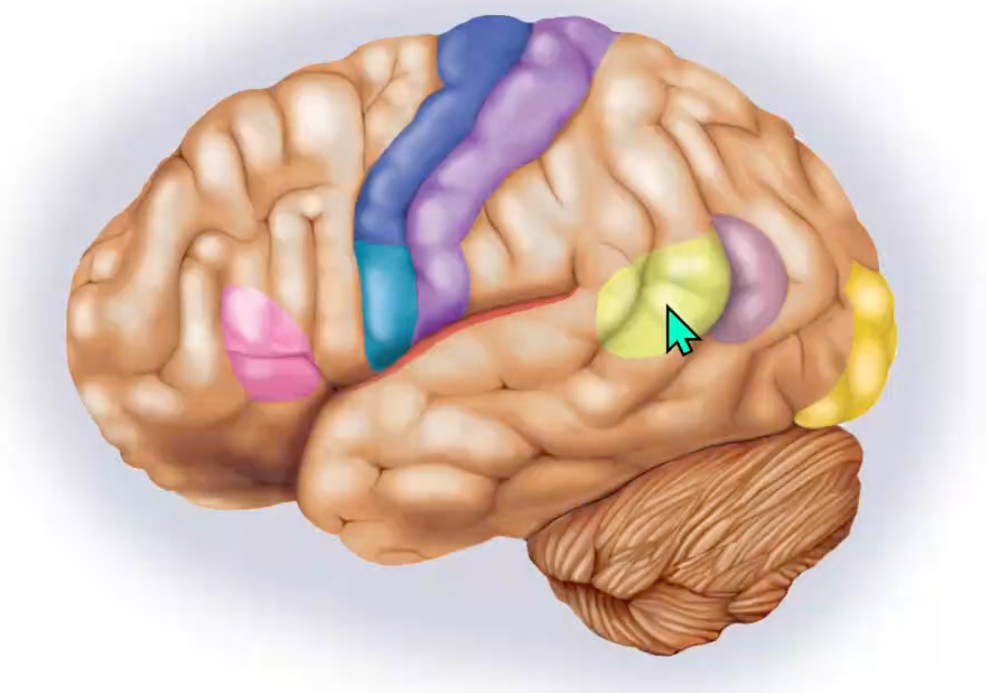 term image