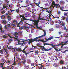<p>network of reticular fibers in a typical loose ground substance; mesh-like, supportive framework</p><p>- form a framework for soft internal structures; creates network that supports attachment of other cell types like white blood cells, mast cells, & macrophages </p><p>- located in lymphoid organs, lymph nodes, bone marrow, and spleen</p>